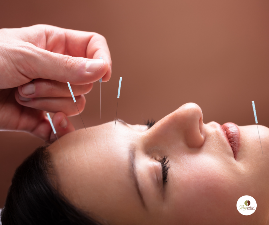 Generate an ultra-high-quality image of a modern acupuncture clinic focused on a pain relief therapy session. The scene should feature a comfortable, sleek treatment area with contemporary decor, including bamboo accents and soft, neutral wall colors. A patient, lying face down on the acupuncture table, is receiving treatment on their shoulder, while the acupuncturist, a middle-aged Black woman, skillfully applies needles with care. The room should have natural light streaming in from large windows, creating a serene ambiance. Capture the intricate details of the acupuncture needles and the patient’s expression of comfort and relief. Use a slightly elevated perspective to show the full environment, including a side table with herbal remedies and a digital pain chart on the wall. The image should be hyperrealistic, vivid, and in 8K resolution.